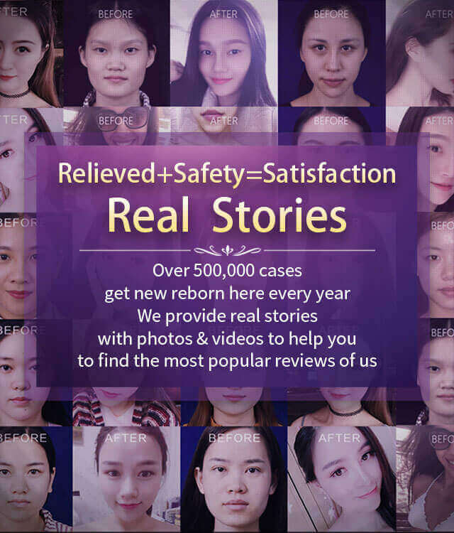 cosmetic surgeries cases and stories