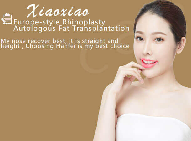 xiaoxiao Europe-style Rhinoplasty，Autologous Fat Transplantation